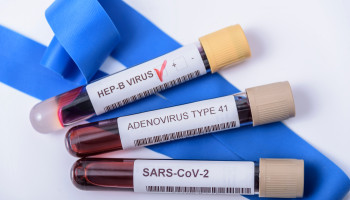 The characteristics of SARS‐CoV‐2‐positive children in Australian hospitals