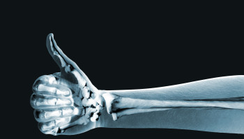 Dual‐energy x‐ray absorptiometry assessment of bone health in Australian men with prostate cancer