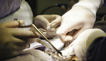 Elective spinal surgery in New South Wales adults, 2001–20, by procedure funding type