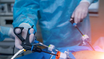 Bariatric surgery: a call for greater access to coordinated surgical and specialist care