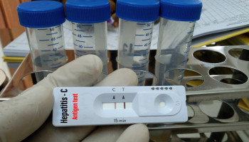 Eliminating hepatitis C in Australia