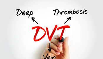 Controversies in the management of proximal deep vein thrombosis