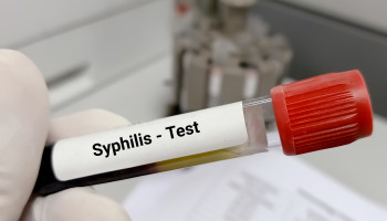 Infectious syphilis in women and heterosexual men in major Australian cities: sentinel surveillance