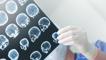 Neuroanaesthesia - Advanced brain monitoring