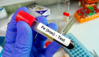 MJA Podcast: Iron deficiency in Aboriginal and Torres Strait Islander peoples, with Dr Sam Heard