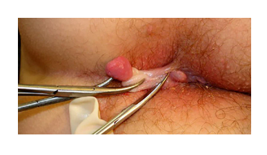 First slide